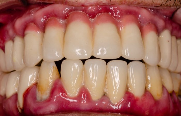 Periodontics - Woodbury Park Dental