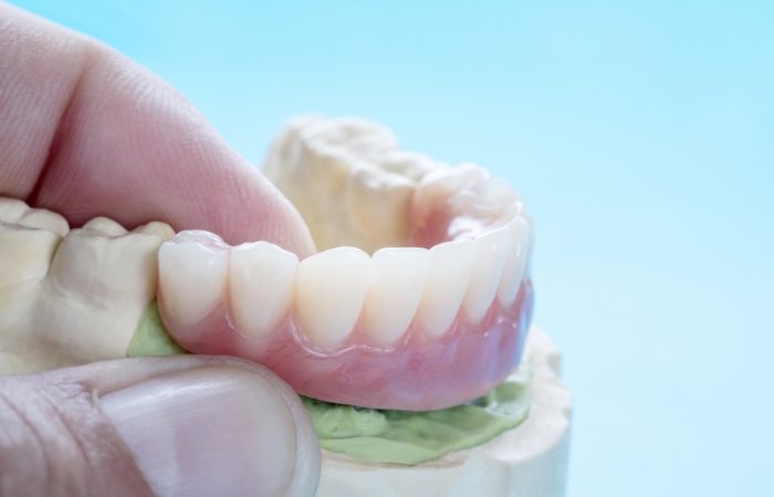 Prosthodontics - Woodbury Park Dental